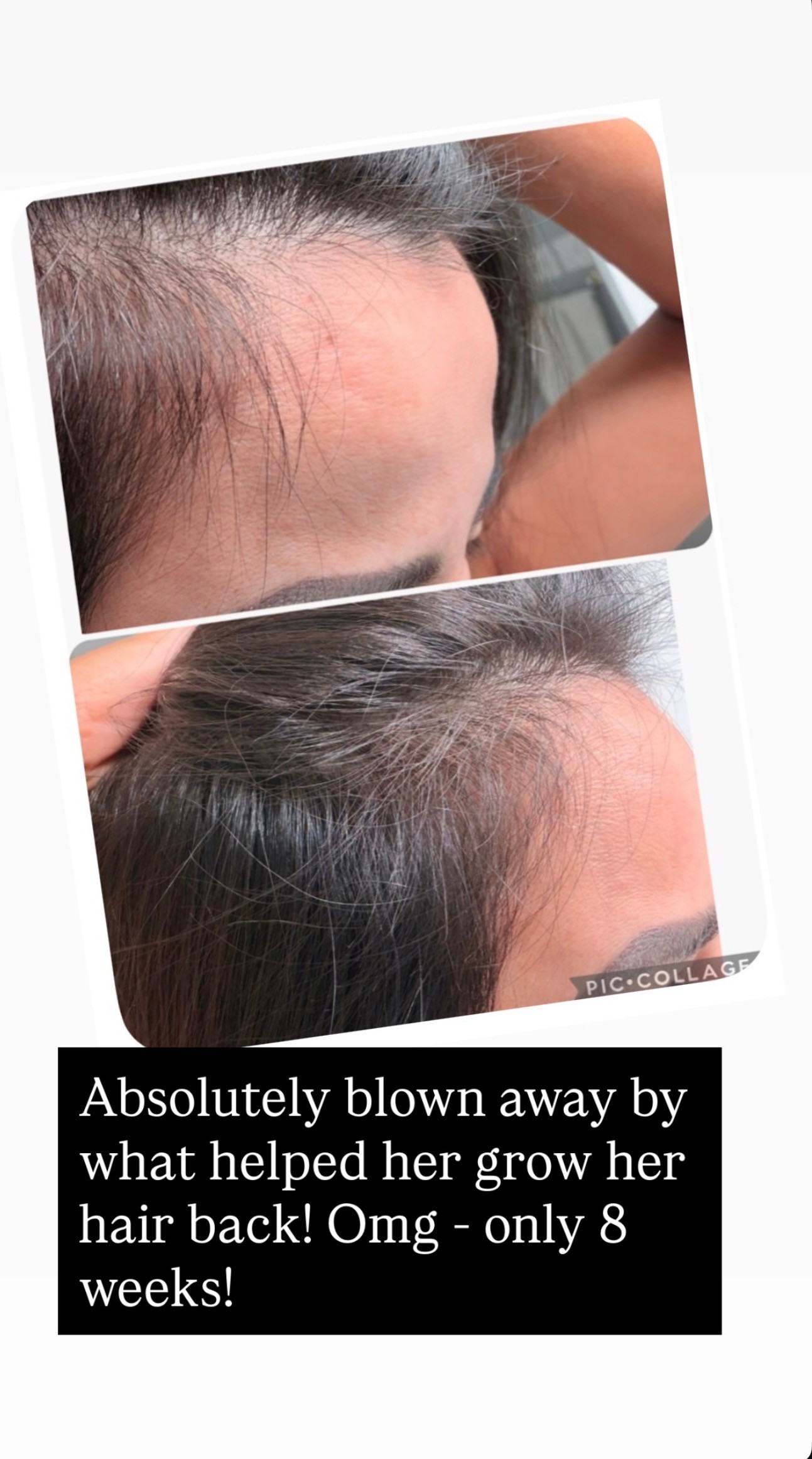 Client hair growth, 8 weeks