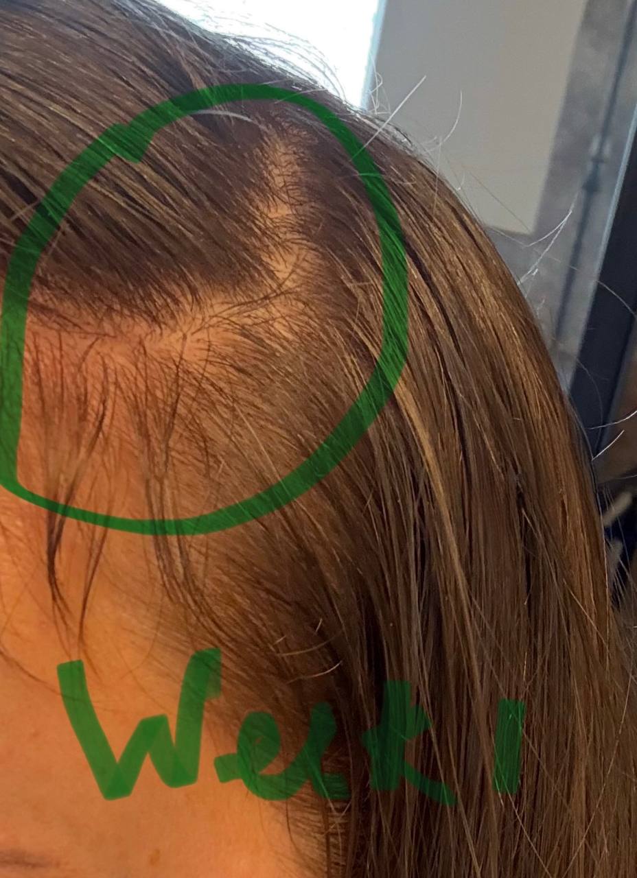 Client hair, week 1
